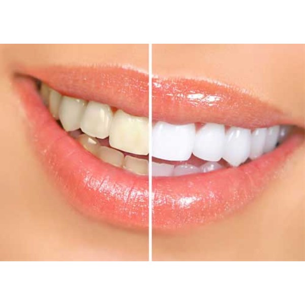 Nirmalam Dr Remitha's Implant Centre+Teeth Whitening