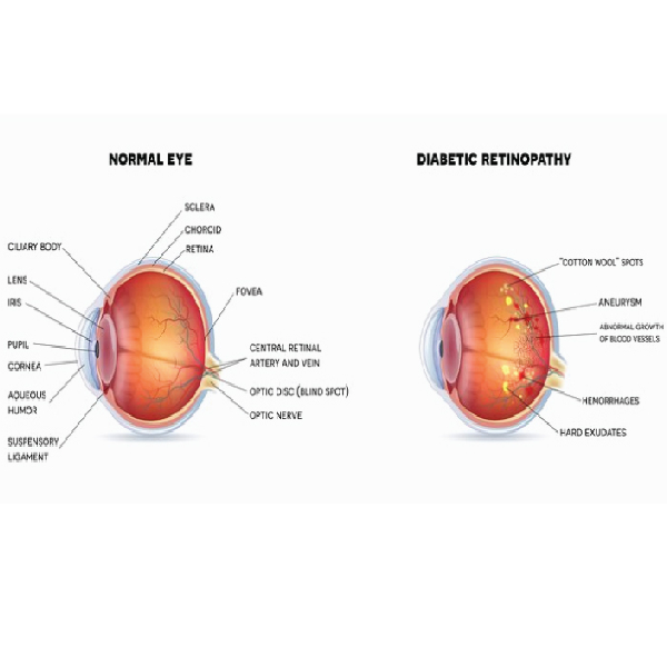 Medical and Surgical Retina