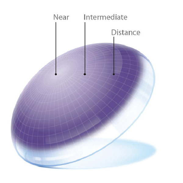 Multifocals Lenses