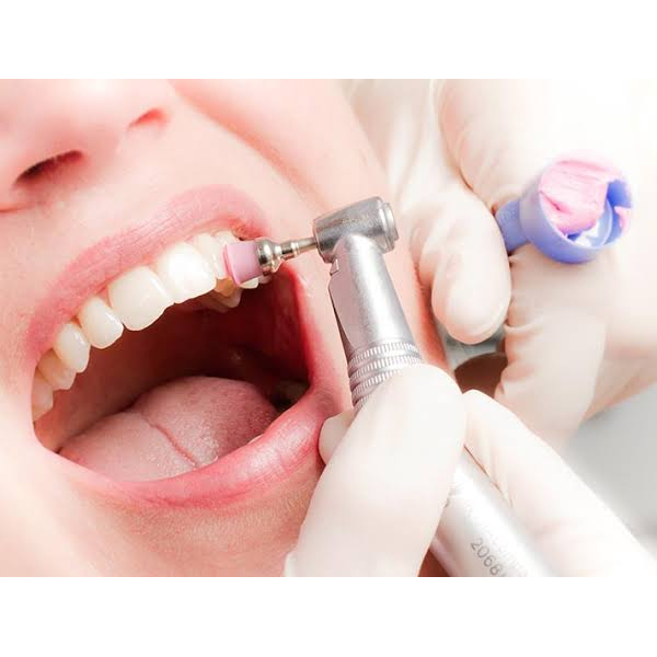 Dental Prophylaxis
