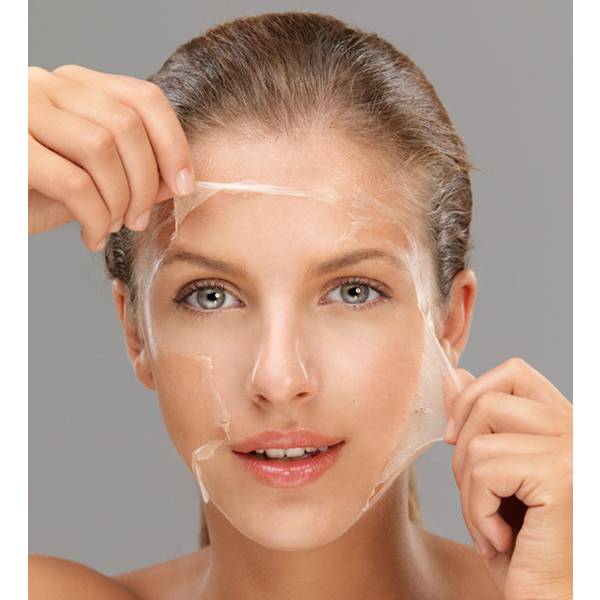 Chemical Peel