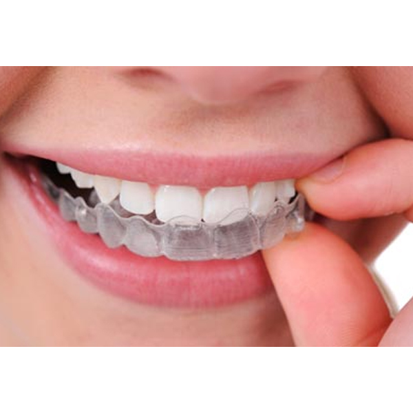 Clear Aligners