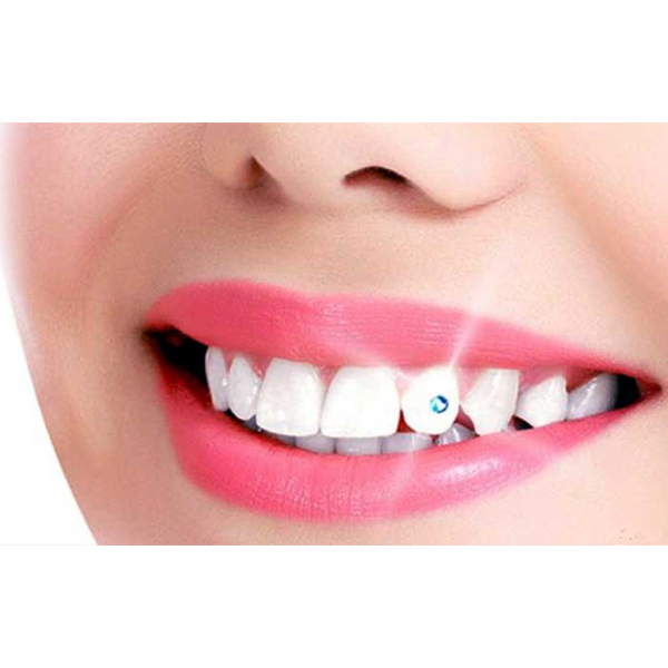 Dental Jewellery