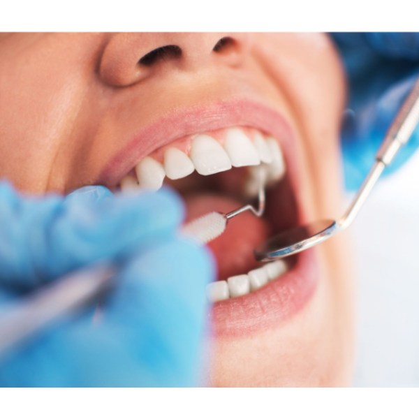 Routine Dental Exam &amp; Check Up