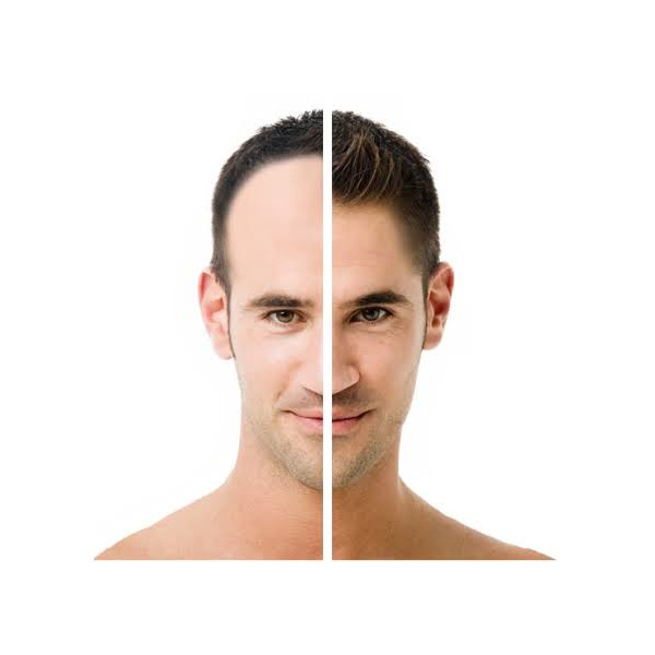 VS Maxillofacial Dental Clinic+Hair Transplantations